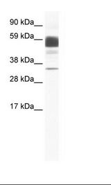 CLDN16 / Claudin 16 Antibody - Fetal Kidney Lysate.  This image was taken for the unconjugated form of this product. Other forms have not been tested.