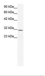 CLDN17 / Claudin 17 Antibody - Jurkat Cell Lysate.  This image was taken for the unconjugated form of this product. Other forms have not been tested.