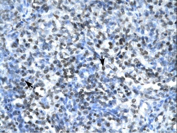 CLDN17 / Claudin 17 Antibody - CLDN17 / Claudin 17 antibody ARP33615_T100-NP_036263-CLDN17 (claudin 17) Antibody was used in IHC to stain formalin-fixed, paraffin-embedded human spleen.  This image was taken for the unconjugated form of this product. Other forms have not been tested.
