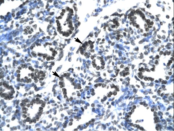 CLDN17 / Claudin 17 Antibody - CLDN17 / Claudin 17 antibody ARP33615_T100-NP_036263-CLDN17 (claudin 17) Antibody was used in IHC to stain formalin-fixed, paraffin-embedded human lung.  This image was taken for the unconjugated form of this product. Other forms have not been tested.