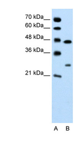 CLDN18 / Claudin 18 Antibody - CLDN18 / Claudin 18 antibody Western blot of Jurkat lysate. This image was taken for the unconjugated form of this product. Other forms have not been tested.