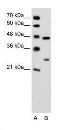 CLDN18 / Claudin 18 Antibody - A: Marker, B: Jurkat Cell Lysate.  This image was taken for the unconjugated form of this product. Other forms have not been tested.