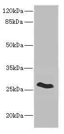 CLDN18 / Claudin 18 Antibody - Western blot All Lanes: CLDN18 antibody IgG at 5.02ug/ml+ Rat heart tissue Secondary Goat polyclonal to rabbit IgG at 1/10000 dilution Predicted band size: 28 kDa Observed band size: 28 kDa