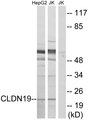 CLDN19 / Claudin 19 Antibody - Western blot analysis of lysates from Jurkat and HepG2 cells, using CLDN19 Antibody. The lane on the right is blocked with the synthesized peptide.