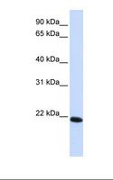 CLDN19 / Claudin 19 Antibody - Transfected 293T cell lysate. Antibody concentration: 1.0 ug/ml. Gel concentration: 12%.  This image was taken for the unconjugated form of this product. Other forms have not been tested.