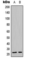 CLDN19 / Claudin 19 Antibody - Western blot analysis of Claudin 19 expression in MCF7 (A); HepG2 (B) whole cell lysates.