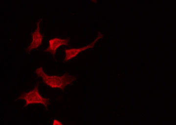 CLDN19 / Claudin 19 Antibody - Staining HeLa cells by IF/ICC. The samples were fixed with PFA and permeabilized in 0.1% Triton X-100, then blocked in 10% serum for 45 min at 25°C. The primary antibody was diluted at 1:200 and incubated with the sample for 1 hour at 37°C. An Alexa Fluor 594 conjugated goat anti-rabbit IgG (H+L) Ab, diluted at 1/600, was used as the secondary antibody.