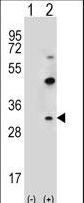 CLDN2 / Claudin 2 Antibody - Western blot of CLDN2 (arrow) using rabbit polyclonal CLDN2 Antibody (Y195). 293 cell lysates (2 ug/lane) either nontransfected (Lane 1) or transiently transfected (Lane 2) with the CLDN2 gene.