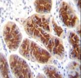 CLDN2 / Claudin 2 Antibody - CLDN2 Antibody (C-term Y224) immunohistochemistry of formalin-fixed and paraffin-embedded human stomach tissue followed by peroxidase-conjugated secondary antibody and DAB staining.