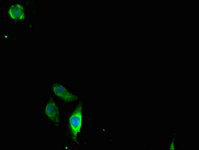 CLDN2 / Claudin 2 Antibody - Immunofluorescent analysis of A549 cells using CLDN2 Antibody at dilution of 1:100 and Alexa Fluor 488-congugated AffiniPure Goat Anti-Rabbit IgG(H+L)