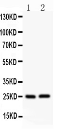 CLDN2 / Claudin 2 Antibody - Claudin 2 antibody Western blot. All lanes: Anti Claudin 2 at 0.5 ug/ml. Lane 1: Rat Kidney Tissue Lysate at 50 ug. Lane 2: Rat Liver Tissue Lysate at 50 ug. Predicted band size: 25 kD. Observed band size: 25 kD.