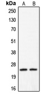 CLDN2 / Claudin 2 Antibody - Western blot analysis of Claudin 2 expression in HeLa (A); A431 (B) whole cell lysates.
