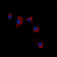 CLDN2 / Claudin 2 Antibody - Immunofluorescent analysis of Claudin 2 staining in A431 cells. Formalin-fixed cells were permeabilized with 0.1% Triton X-100 in TBS for 5-10 minutes and blocked with 3% BSA-PBS for 30 minutes at room temperature. Cells were probed with the primary antibody in 3% BSA-PBS and incubated overnight at 4 C in a humidified chamber. Cells were washed with PBST and incubated with a DyLight 594-conjugated secondary antibody (red) in PBS at room temperature in the dark. DAPI was used to stain the cell nuclei (blue).