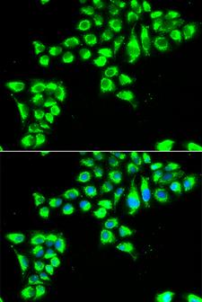 CLDN2 / Claudin 2 Antibody - Immunofluorescence analysis of HeLa cells.