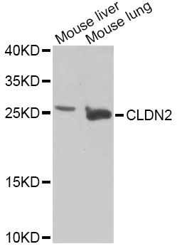 CLDN2 / Claudin 2 Antibody - Western blot analysis of extracts of various cell lines, using CLDN2 Antibody at 1:1000 dilution. The secondary antibody used was an HRP Goat Anti-Rabbit IgG (H+L) at 1:10000 dilution. Lysates were loaded 25ug per lane and 3% nonfat dry milk in TBST was used for blocking. An ECL Kit was used for detection and the exposure time was 30s.