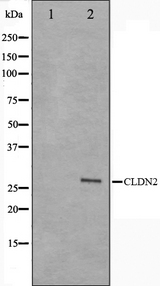 CLDN2 / Claudin 2 Antibody - Western blot analysis on NIH-3T3 cell lysates using Claudin 2 antibody. The lane on the left is treated with the antigen-specific peptide.