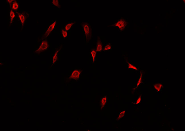 CLDN2 / Claudin 2 Antibody - Staining A549 cells by IF/ICC. The samples were fixed with PFA and permeabilized in 0.1% Triton X-100, then blocked in 10% serum for 45 min at 25°C. The primary antibody was diluted at 1:200 and incubated with the sample for 1 hour at 37°C. An Alexa Fluor 594 conjugated goat anti-rabbit IgG (H+L) antibody, diluted at 1/600, was used as secondary antibody.