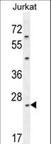 CLDN22 / Claudin 22 Antibody - CLDN22 Antibody western blot of Jurkat cell line lysates (35 ug/lane). The CLDN22 antibody detected the CLDN22 protein (arrow).