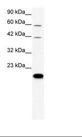 CLDN23 / Claudin 23 Antibody - HepG2 Cell Lysate.  This image was taken for the unconjugated form of this product. Other forms have not been tested.