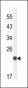 CLDN23 / Claudin 23 Antibody - Western blot of CLDN23 Antibody in mouse bladder tissue lysates (35 ug/lane). CLDN23 (arrow) was detected using the purified antibody.
