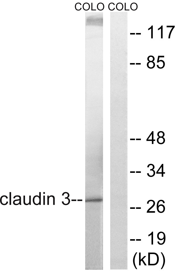 CLDN3 / Claudin 3 Antibody - Western blot analysis of lysates from COLO205 cells, treated with EGF 200ng/ml 30', using Claudin 3 Antibody. The lane on the right is blocked with the synthesized peptide.