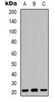 CLDN3 / Claudin 3 Antibody - Western blot analysis of Claudin 3 expression in HeLa (A); HEK293T (B); NIH3T3 (C) whole cell lysates.