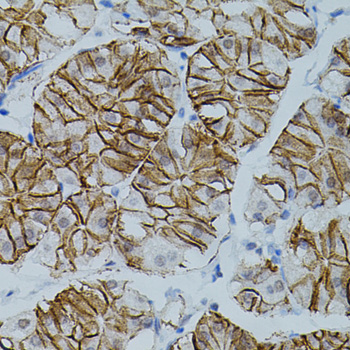 CLDN3 / Claudin 3 Antibody - Immunohistochemistry of paraffin-embedded human stomach tissue.