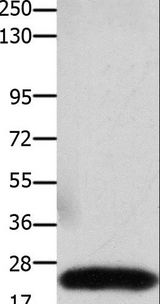 CLDN3 / Claudin 3 Antibody - Western blot analysis of Human colon cancer tissue, using CLDN3 Polyclonal Antibody at dilution of 1:550.