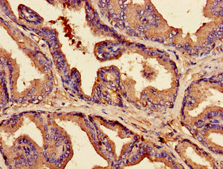 CLDN3 / Claudin 3 Antibody - Immunohistochemistry image of paraffin-embedded human prostate tissue at a dilution of 1:100