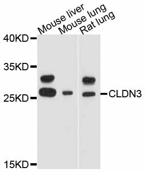 CLDN3 / Claudin 3 Antibody - Western blot analysis of extracts of various cell lines, using CLDN3 antibody at 1:3000 dilution. The secondary antibody used was an HRP Goat Anti-Rabbit IgG (H+L) at 1:10000 dilution. Lysates were loaded 25ug per lane and 3% nonfat dry milk in TBST was used for blocking. An ECL Kit was used for detection and the exposure time was 20s.