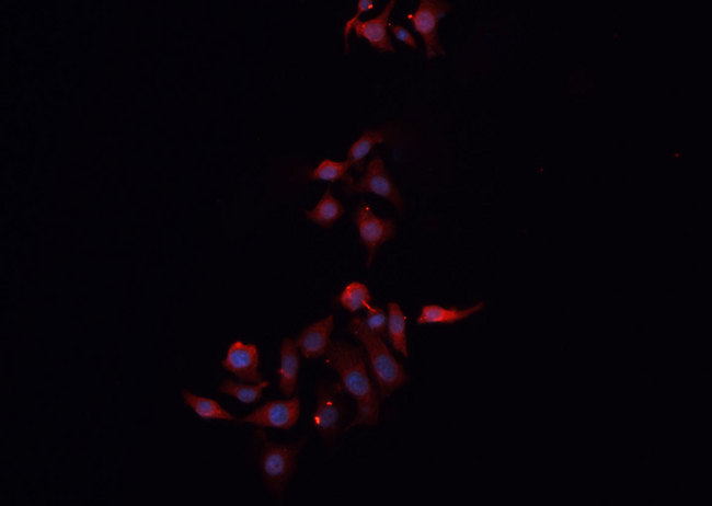 CLDN3 / Claudin 3 Antibody - Staining MCF-7 cells by IF/ICC. The samples were fixed with PFA and permeabilized in 0.1% Triton X-100, then blocked in 10% serum for 45 min at 25°C. The primary antibody was diluted at 1:200 and incubated with the sample for 1 hour at 37°C. An Alexa Fluor 594 conjugated goat anti-rabbit IgG (H+L) antibody, diluted at 1/600, was used as secondary antibody.