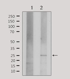 CLDN3 / Claudin 3 Antibody - Western blot analysis of extracts of HepG2 cells using Claudin 3 antibody. Lane 1 was treated with the antigen-specific peptide.