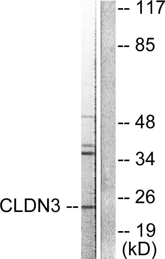 CLDN3 / Claudin 3 Antibody - Western blot analysis of extracts from HuvEc cells, using Claudin 3 antibody.