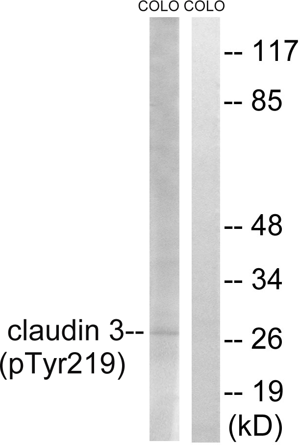 CLDN3 / Claudin 3 Antibody - Western blot analysis of lysates from COLO205 cells treated with EGF 200ng/ml 30', using Claudin 3 (Phospho-Tyr219) Antibody. The lane on the right is blocked with the phospho peptide.