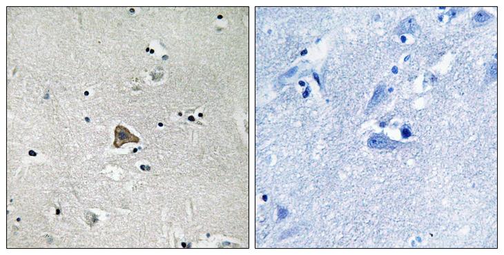 CLDN4 / Claudin 4 Antibody - Immunohistochemistry analysis of paraffin-embedded human brain tissue, using Claudin 4 Antibody. The picture on the right is blocked with the synthesized peptide.