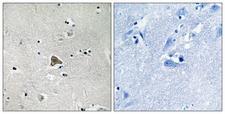 CLDN4 / Claudin 4 Antibody - Immunohistochemistry analysis of paraffin-embedded human brain tissue, using Claudin 4 Antibody. The picture on the right is blocked with the synthesized peptide.