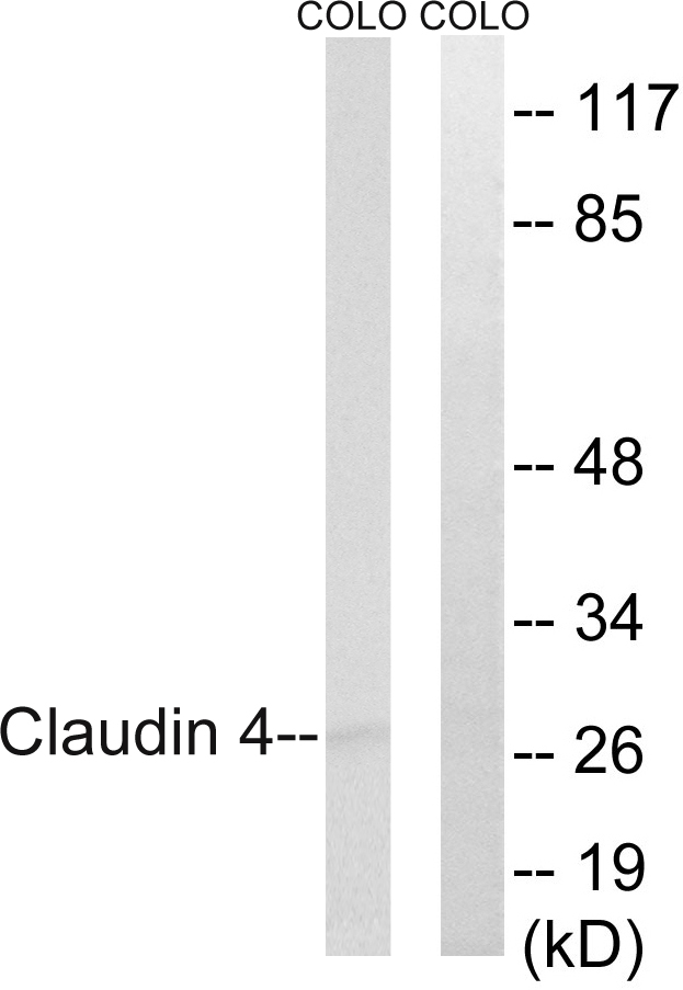 CLDN4 / Claudin 4 Antibody - Western blot analysis of lysates from COLO cells, using Claudin 4 Antibody. The lane on the right is blocked with the synthesized peptide.