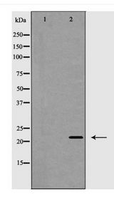 CLDN4 / Claudin 4 Antibody - Western blot of Claudin 4 expression in HeLa cells