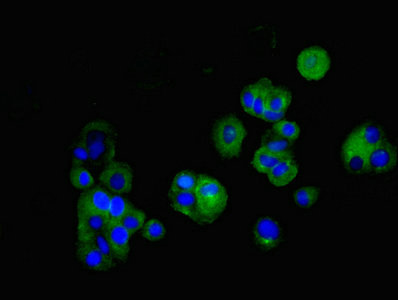 CLDN5 / Claudin 5 Antibody - Immunofluorescent analysis of MCF-7 cells at a dilution of 1:100 and Alexa Fluor 488-congugated AffiniPure Goat Anti-Rabbit IgG(H+L)
