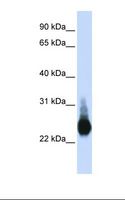CLDN5 / Claudin 5 Antibody - Transfected 293T cell lysate. Antibody concentration: 1.0 ug/ml. Gel concentration: 12%.  This image was taken for the unconjugated form of this product. Other forms have not been tested.