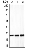 CLDN5 / Claudin 5 Antibody - Western blot analysis of Claudin 5 expression in HeLa (A); mouse liver (B); rat lung (C) whole cell lysates.