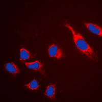 CLDN5 / Claudin 5 Antibody - Immunofluorescent analysis of Claudin 5 staining in HeLa cells. Formalin-fixed cells were permeabilized with 0.1% Triton X-100 in TBS for 5-10 minutes and blocked with 3% BSA-PBS for 30 minutes at room temperature. Cells were probed with the primary antibody in 3% BSA-PBS and incubated overnight at 4 C in a humidified chamber. Cells were washed with PBST and incubated with a DyLight 594-conjugated secondary antibody (red) in PBS at room temperature in the dark. DAPI was used to stain the cell nuclei (blue).