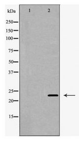 CLDN5 / Claudin 5 Antibody - Western blot of Claudin 5 expression in A549 cell