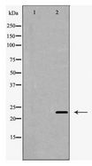 CLDN5 / Claudin 5 Antibody - Western blot of Claudin 5 expression in A549 cell