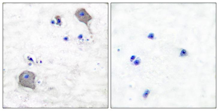 CLDN5 / Claudin 5 Antibody - Peptide - + Immunohistochemical analysis of paraffin-embedded human brain tissue using Claudin 5 antibody.