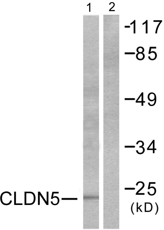 CLDN5 / Claudin 5 Antibody - Western blot analysis of extracts from A549 cells, using Claudin 5 antibody.