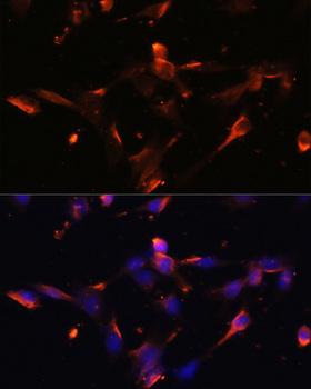 CLDN5 / Claudin 5 Antibody - Immunofluorescence analysis of NIH/3T3 cells using CLDN5 Polyclonal Antibody at dilution of 1:100.Blue: DAPI for nuclear staining.