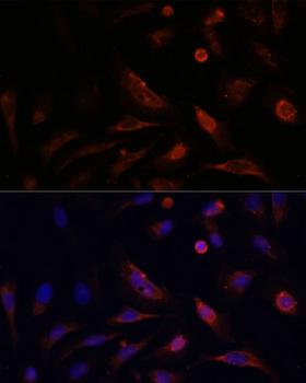 CLDN5 / Claudin 5 Antibody - Immunofluorescence analysis of U2OS cells using CLDN5 Polyclonal Antibody at dilution of 1:100.Blue: DAPI for nuclear staining.