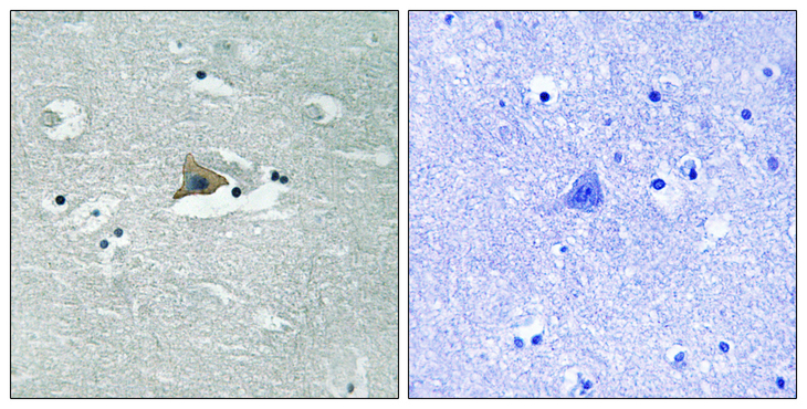 CLDN5 / Claudin 5 Antibody - Immunohistochemistry analysis of paraffin-embedded human brain, using Claudin 5 (Phospho-Tyr217) Antibody. The picture on the right is blocked with the phospho peptide.