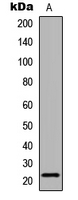 CLDN6 / Claudin 6 Antibody - Western blot analysis of Claudin 6 expression in COLO205 (A) whole cell lysates.